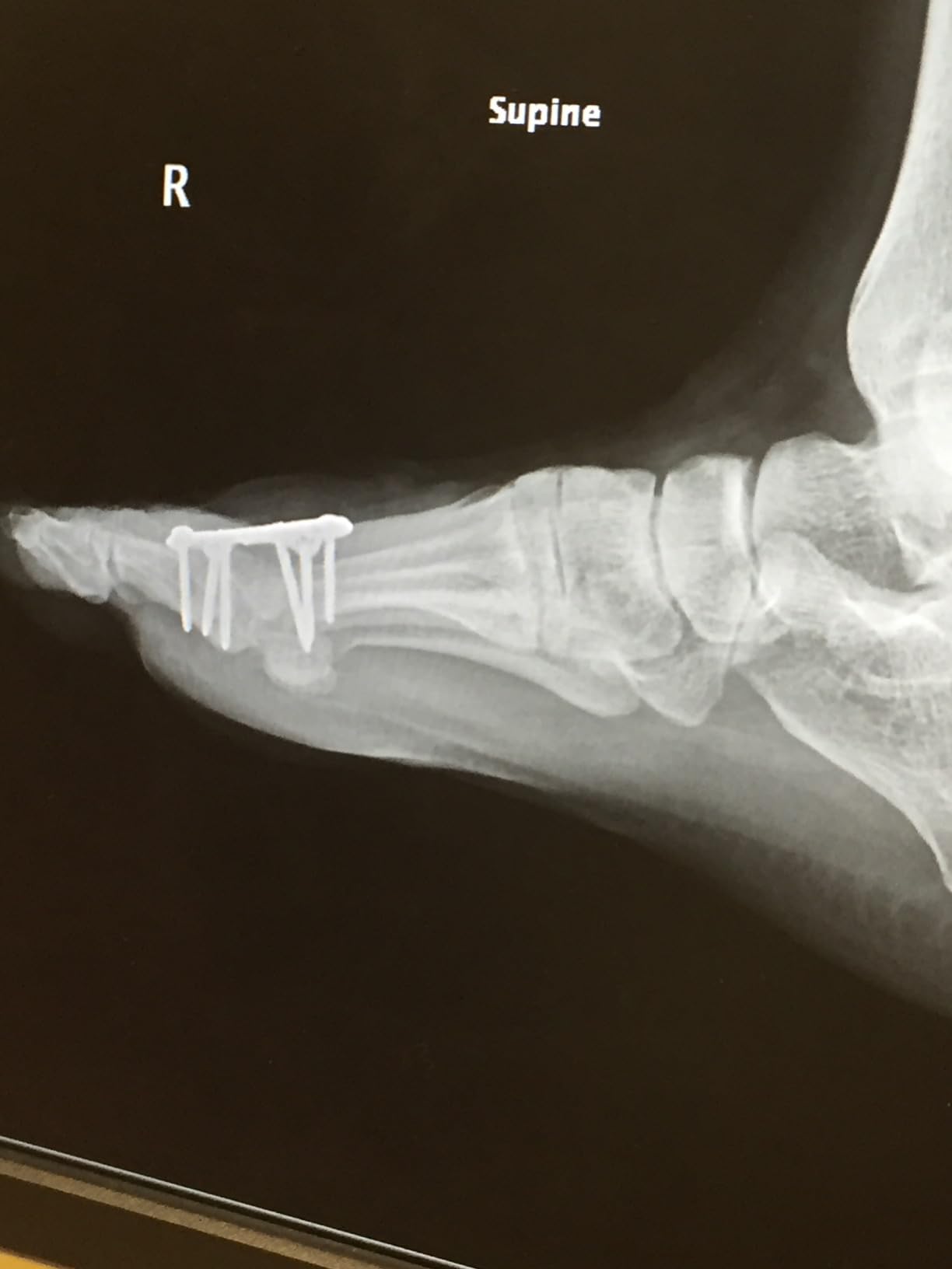 New Balance 840v1 thick Fresh Foam X midsole cushioning system close-up